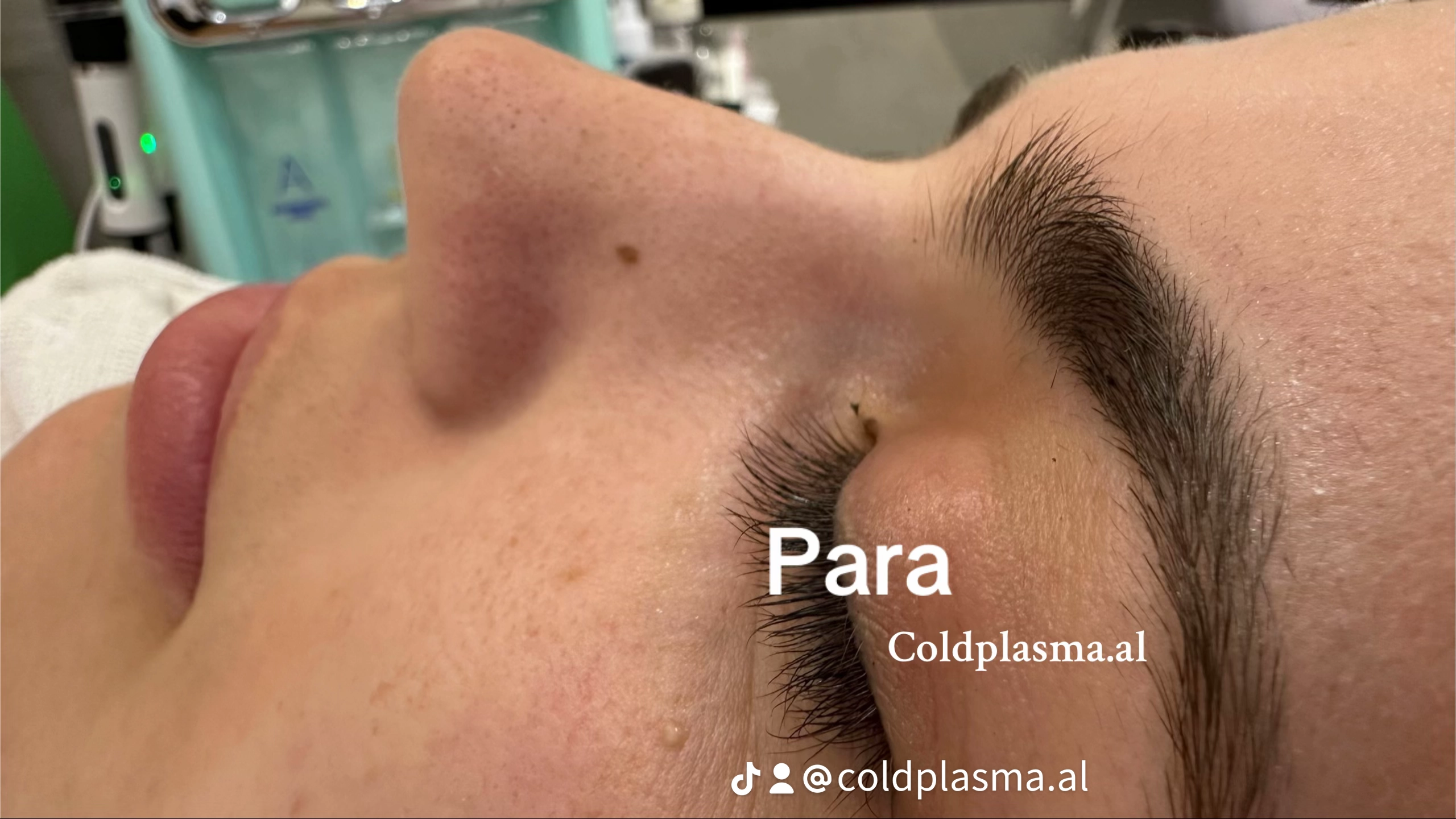 ___trajtim-me-plazem-shkoder-estetike-193